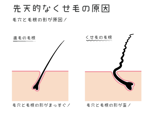 毛根を矯正 くせ毛に効く薬 手術はある 天パを根本的に治してストレートになれる You Tokyo Official Blog